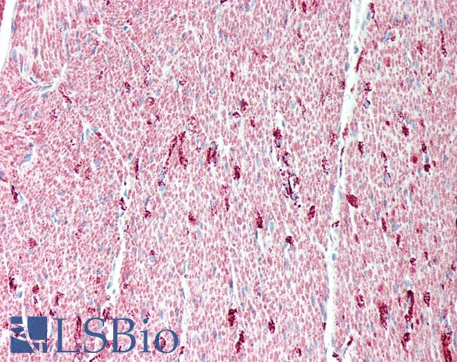 DES / Desmin Antibody - Human colon, smooth muscle: Formalin-Fixed, Paraffin-Embedded (FFPE)