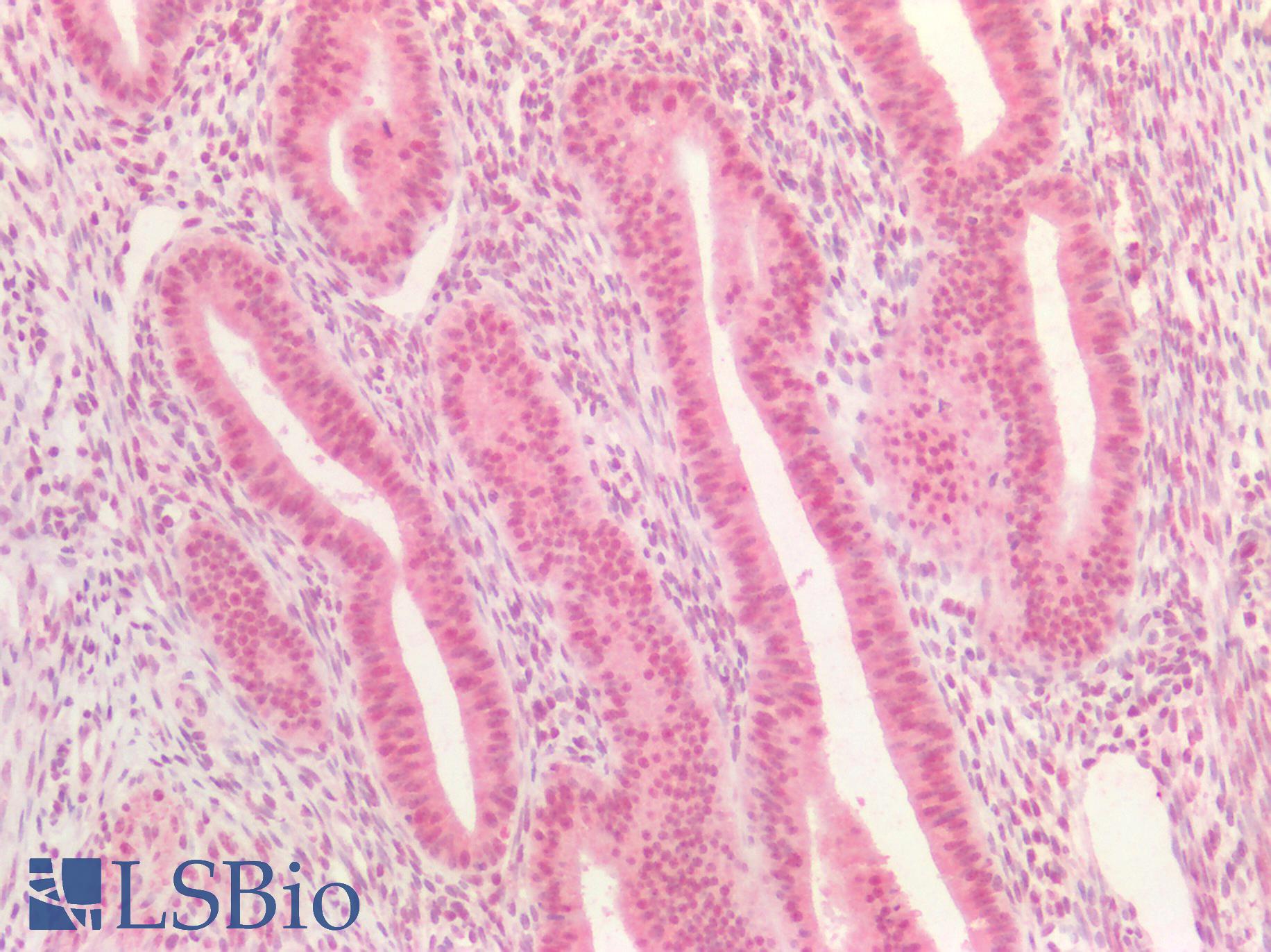 DNMT / DNMT1 Antibody - Human Uterus: Formalin-Fixed, Paraffin-Embedded (FFPE)
