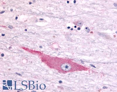 DUSP22 / JSP 1 Antibody - Brain, Hypothalamus