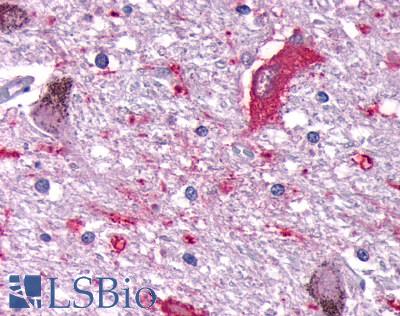 DUSP26 / MKP8 Antibody - Brain, substantia nigra