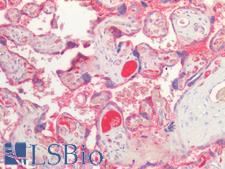 EBI3 / IL-27B Antibody - Human Placenta: Formalin-Fixed, Paraffin-Embedded (FFPE)