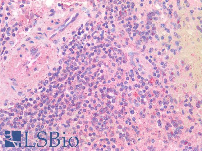 EBI3 / IL-27B Antibody - Human Spleen: Formalin-Fixed, Paraffin-Embedded (FFPE)