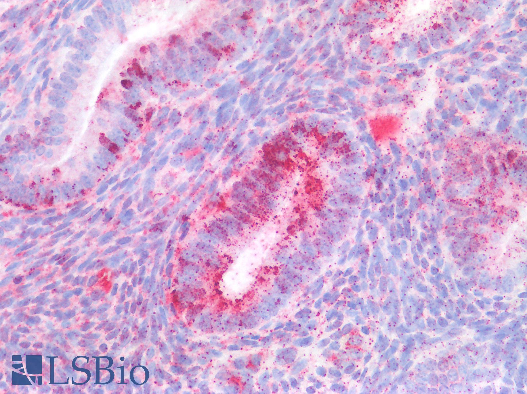 EBI3 / IL-27B Antibody - Human Uterus: Formalin-Fixed, Paraffin-Embedded (FFPE)