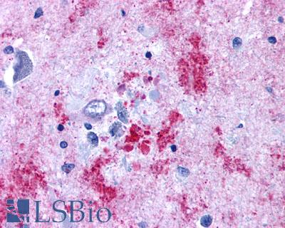 EDNRB / Endothelin B Receptor Antibody - Brain, Alzheimer's senile plaque