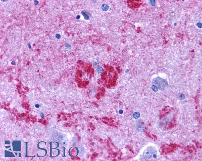 EDNRB / Endothelin B Receptor Antibody - Brain, Dementia, Senile Plaque