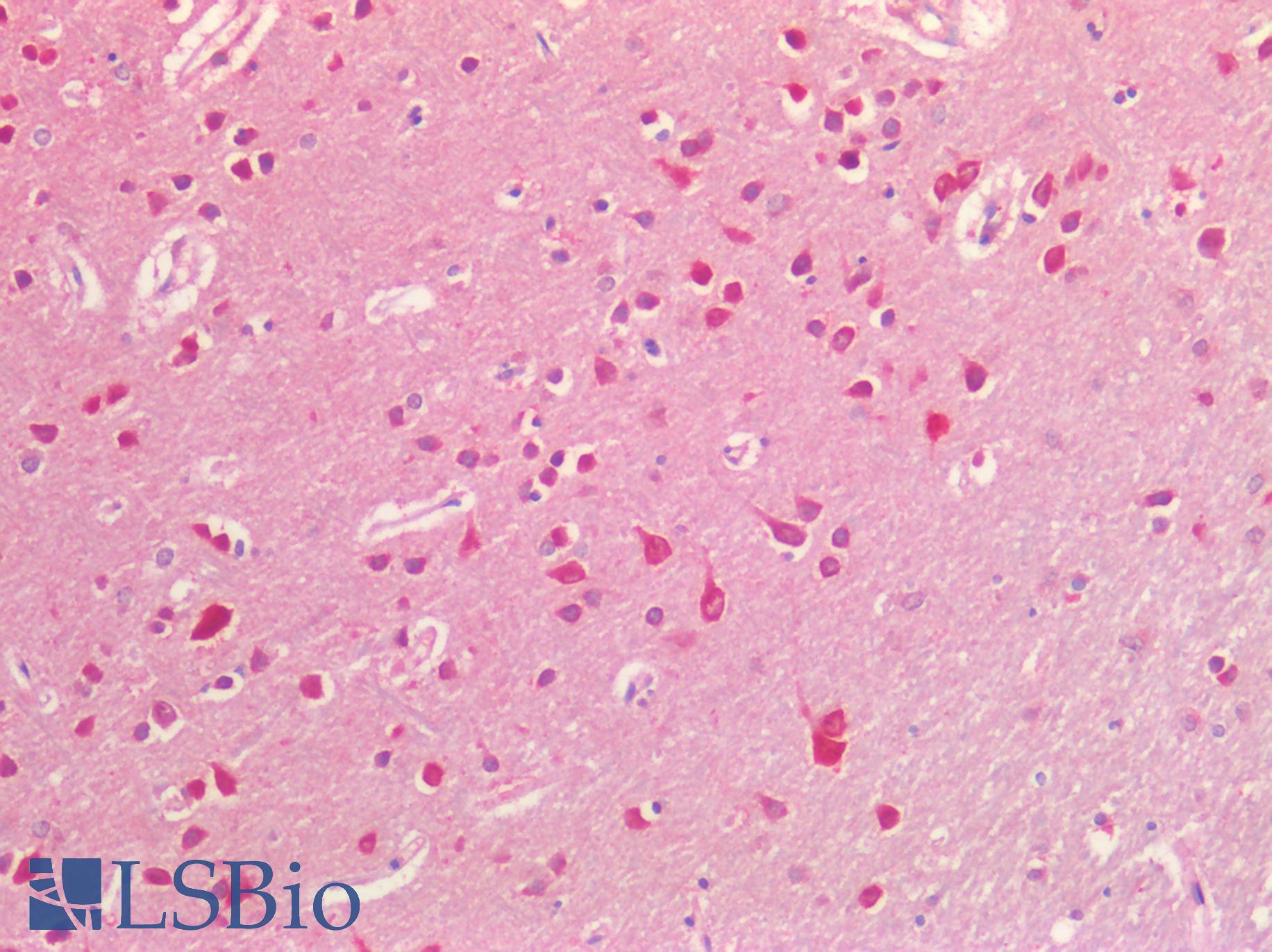 EFNB2 / Ephrin B2 Antibody - Human Brain, Cortex: Formalin-Fixed, Paraffin-Embedded (FFPE)