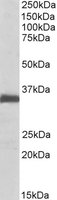 EFNB2 / Ephrin B2 Antibody - EFNB2 antibody (0.1 ug/ml) staining of Rat Lung lysate (35 ug protein/ml in RIPA buffer). Primary incubation was 1 hour. Detected by chemiluminescence.