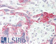 EGFR Antibody - Human Placenta, trophoblasts: Formalin-Fixed, Paraffin-Embedded (FFPE)