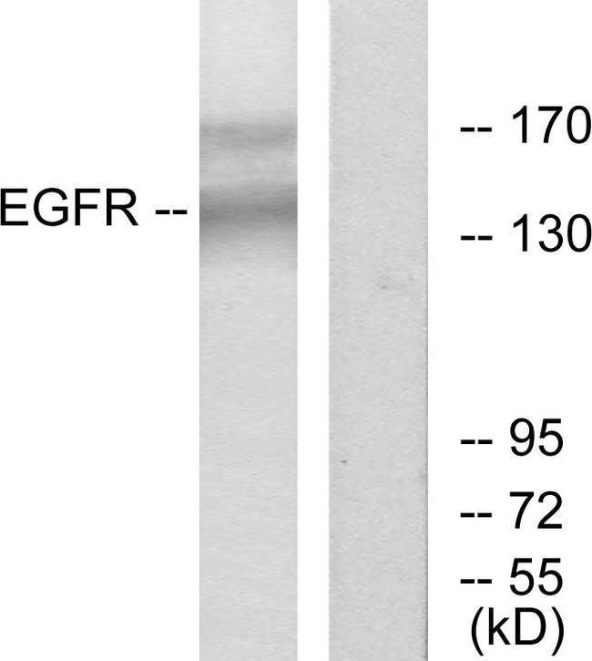 EGFR Antibody - Western blot analysis of lysates from HT-29 cells, using EGFR Antibody. The lane on the right is blocked with the synthesized peptide.
