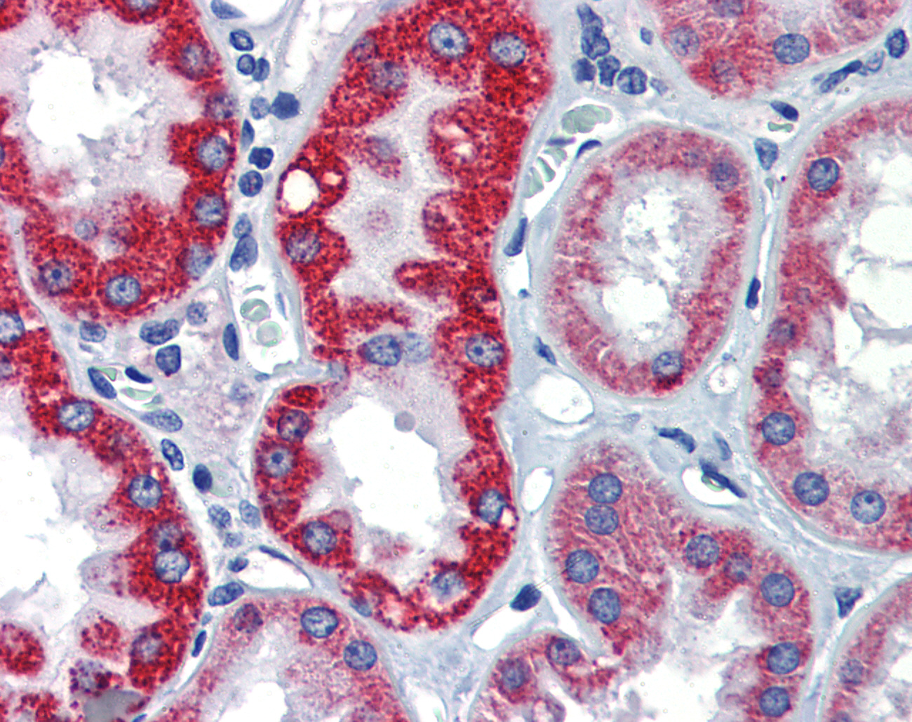 EGR2 Antibody - Anti-EGR2 antibody IHC of human kidney. Immunohistochemistry of formalin-fixed, paraffin-embedded tissue after heat-induced antigen retrieval. Antibody concentration 5 ug/ml.  This image was taken for the unconjugated form of this product. Other forms have not been tested.