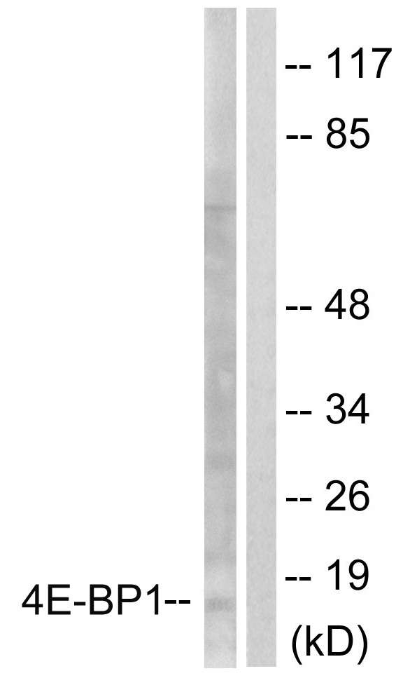 EIF4EBP1 / 4EBP1 Antibody - Western blot analysis of lysates from Jurkat cells, treated with Insulin 0.01U/ml 15', using 4E-BP1 Antibody. The lane on the right is blocked with the synthesized peptide.