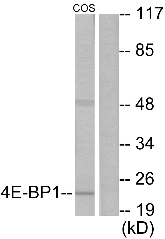 EIF4EBP1 / 4EBP1 Antibody - Western blot analysis of lysates from COS7 cells, treated with EGF 200ng/ml 30', using 4E-BP1 Antibody. The lane on the right is blocked with the synthesized peptide.