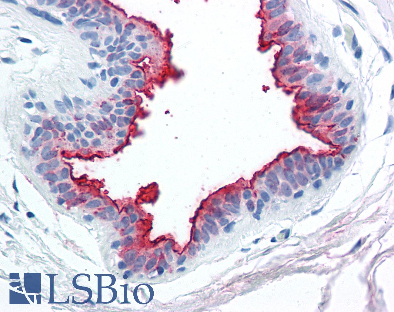 EMA / MUC1 Antibody - Human Breast: Formalin-Fixed, Paraffin-Embedded (FFPE)