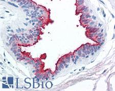 EMA / MUC1 Antibody - Human Breast: Formalin-Fixed, Paraffin-Embedded (FFPE)