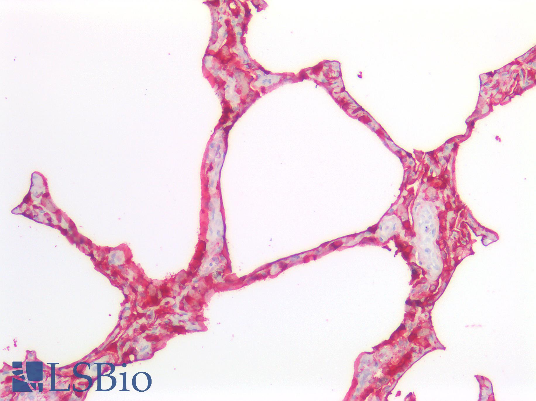 EMA / MUC1 Antibody - Human Lung: Formalin-Fixed, Paraffin-Embedded (FFPE)