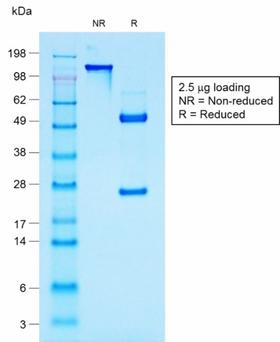 EMA / MUC1 Antibody - SDS-PAGE Analysis Purified MUC1 Mouse Recombinant Monoclonal Antibody (rMUC1/960). Confirmation of Purity and Integrity of Antibody.