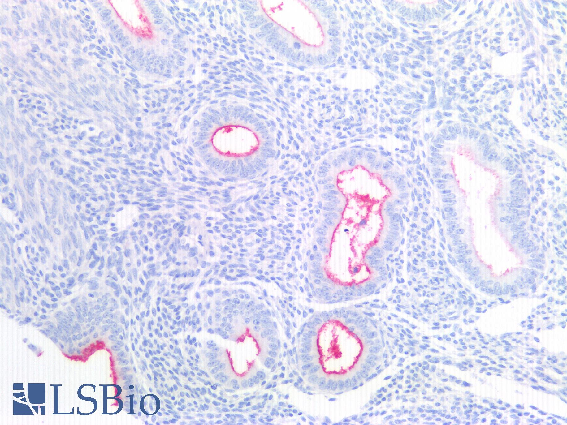 EMA / MUC1 Antibody - Human Uterus: Formalin-Fixed, Paraffin-Embedded (FFPE)