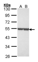 ENO1 / Alpha Enolase Antibody - Sample (30 ug of whole cell lysate). A: A431 , B: H1299. 10% SDS PAGE. ENO1 / Alpha Enolase antibody diluted at 1:3000