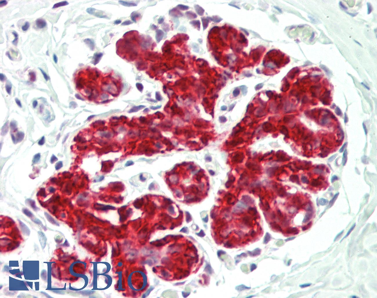 ENO1 / Alpha Enolase Antibody - Human Breast: Formalin-Fixed, Paraffin-Embedded (FFPE)