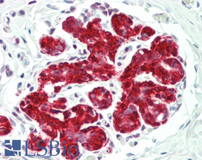 ENO1 / Alpha Enolase Antibody - Human Breast: Formalin-Fixed, Paraffin-Embedded (FFPE)