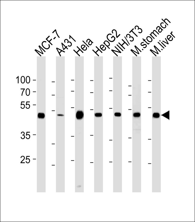 ENO1 / Alpha Enolase Antibody - ENO1 Antibody western blot of MCF-7,A431,HeLa,HepG2,mouse NIH/3T3 cell line and mouse stomach,liver tissue lysates (35 ug/lane). The ENO1 antibody detected the ENO1 protein (arrow).