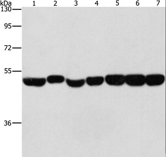 ENO1 / Alpha Enolase Antibody - Western blot analysis of HeLa, A431 and hepG2 cell, mouse brain and liver tissue, mouse pancreas and human fetal brain tissue, using ENO1 Polyclonal Antibody at dilution of 1:700.