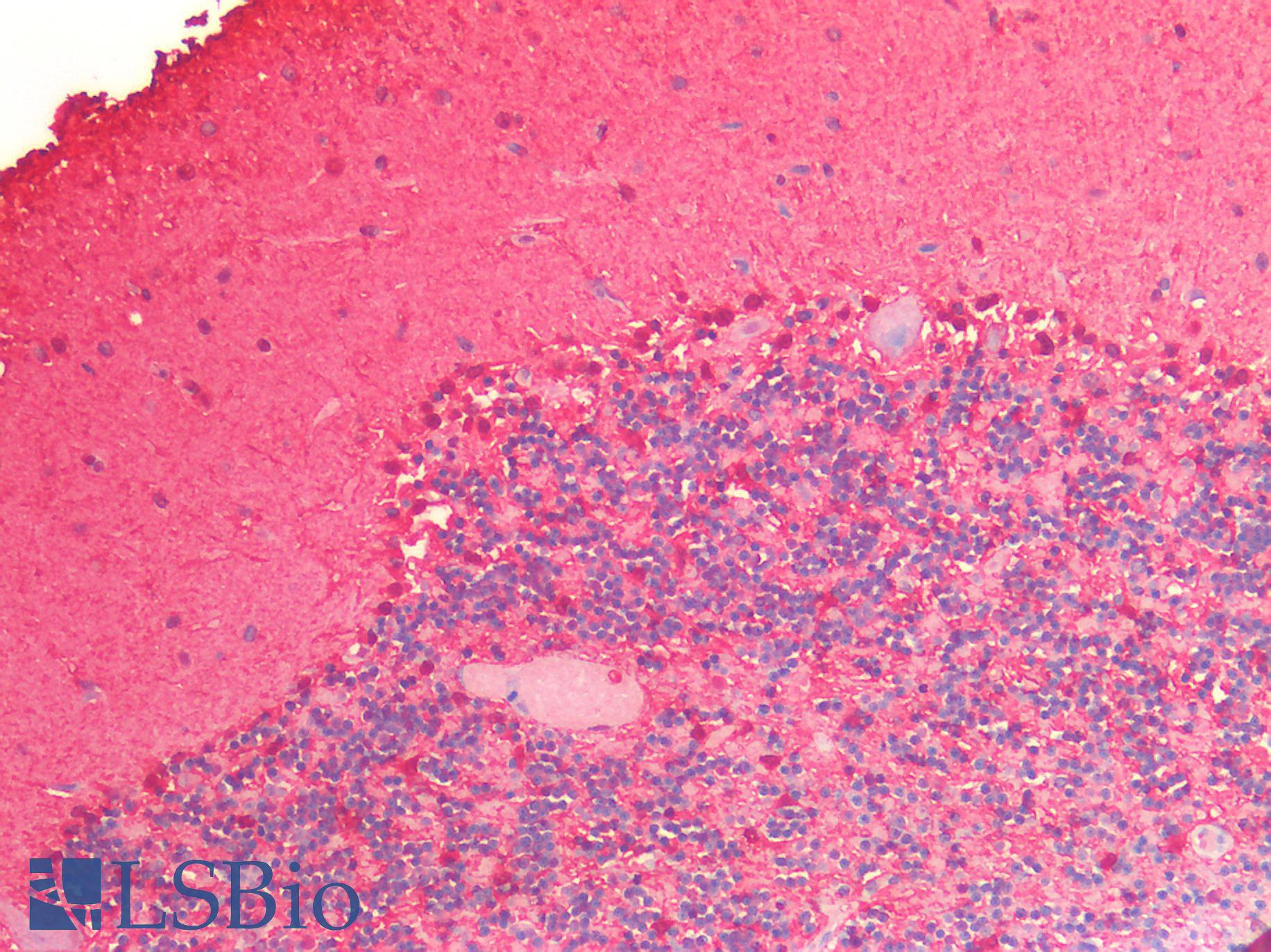 ENO1 / Alpha Enolase Antibody - Human Brain, Cerebellum: Formalin-Fixed, Paraffin-Embedded (FFPE)