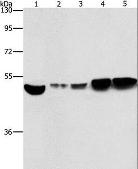 ENO1 / Alpha Enolase Antibody - Western blot analysis of HeLa and A431 cell, mouse brain and liver tissue, mouse pancreas tissue, using ENO1 Polyclonal Antibody at dilution of 1:500.