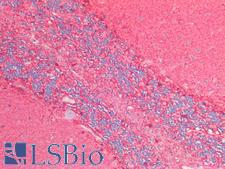 ENO1 / Alpha Enolase Antibody - Human Brain. Cerebellum: Formalin-Fixed, Paraffin-Embedded (FFPE)