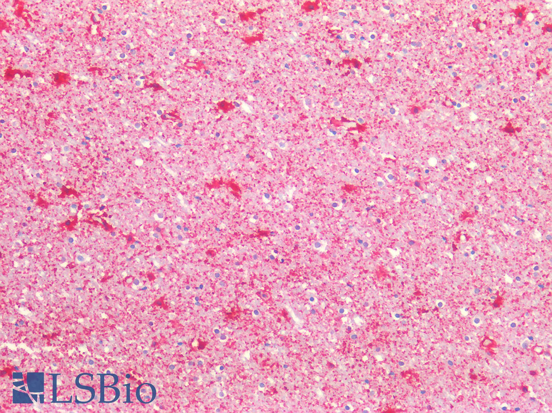 ENO1 / Alpha Enolase Antibody - Human Brain. Cortex: Formalin-Fixed, Paraffin-Embedded (FFPE)
