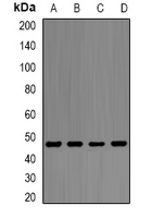 ENO1 / Alpha Enolase Antibody - Western blot analysis of Alpha-enolase expression in PC3 (A); Ramos (B); HeLa (C); THP1 (D) whole cell lysates.