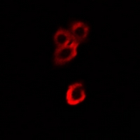 ENO1 / Alpha Enolase Antibody - Immunofluorescent analysis of Alpha-enolase staining in HeLa cells. Formalin-fixed cells were permeabilized with 0.1% Triton X-100 in TBS for 5-10 minutes and blocked with 3% BSA-PBS for 30 minutes at room temperature. Cells were probed with the primary antibody in 3% BSA-PBS and incubated overnight at 4 deg C in a humidified chamber. Cells were washed with PBST and incubated with a DyLight 594-conjugated secondary antibody (red) in PBS at room temperature in the dark.