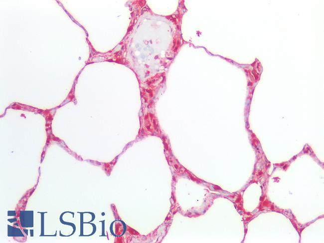 ENO1 / Alpha Enolase Antibody - Human Lung: Formalin-Fixed, Paraffin-Embedded (FFPE)