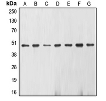 ENO2 / NSE Antibody - Western blot analysis of Gamma-enolase expression in U937 (A); K562 (B); Jurkat (C); NIH3T3 (D); KNRK (E); HepG2 (F); HeLa (G) whole cell lysates.