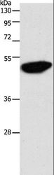 ENO2 / NSE Antibody - Western blot analysis of Jurkat cell, using ENO2 Polyclonal Antibody at dilution of 1:750.