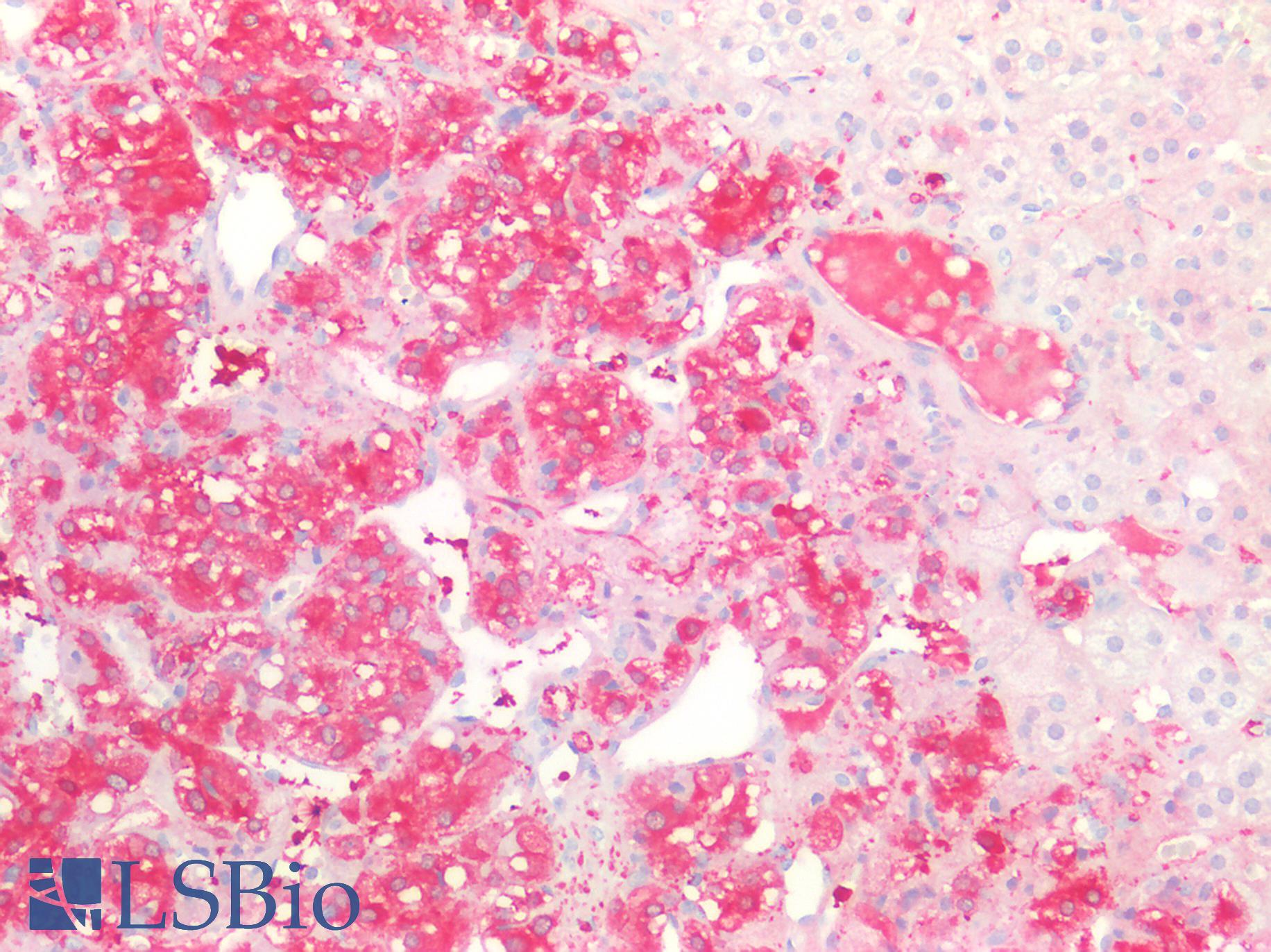 ENO2 / NSE Antibody - Human Adrenal: Formalin-Fixed, Paraffin-Embedded (FFPE)