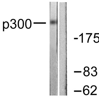 EP300 / p300 Antibody - Western blot analysis of lysates from MDA-MB-435 cells, using p300 Antibody. The lane on the right is blocked with the synthesized peptide.