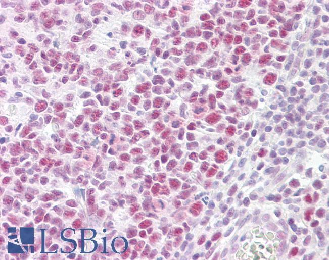 EP300 / p300 Antibody - Anti-EP300 / p300 antibody IHC of human tonsil. Immunohistochemistry of formalin-fixed, paraffin-embedded tissue after heat-induced antigen retrieval. Antibody dilution 1:100.