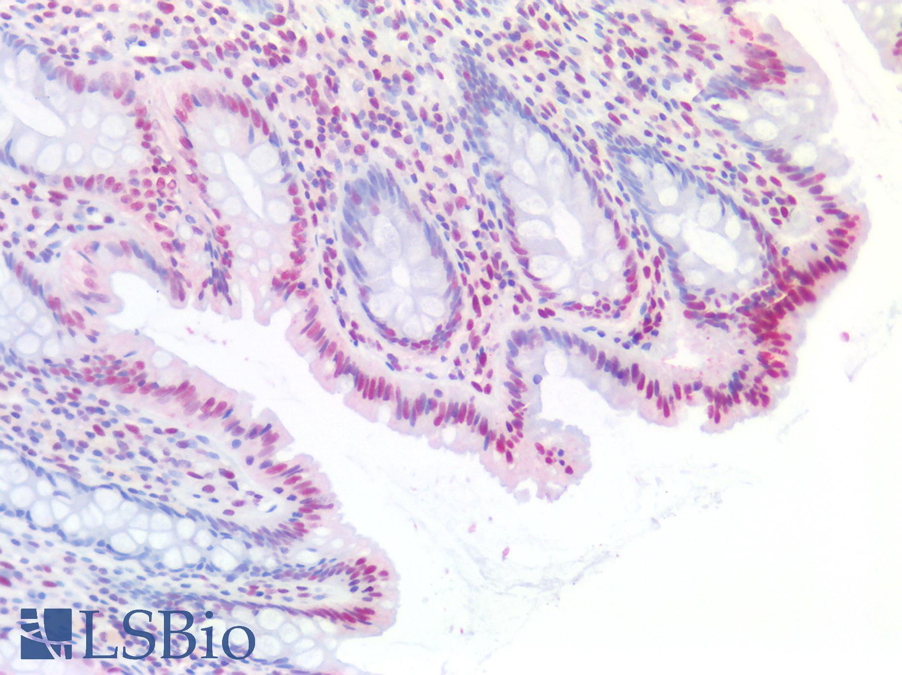 EP300 / p300 Antibody - Human Colon: Formalin-Fixed, Paraffin-Embedded (FFPE)