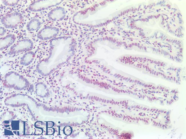 EP300 / p300 Antibody - Human Small Intestine: Formalin-Fixed, Paraffin-Embedded (FFPE)