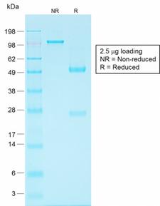 EPCAM Antibody - SDS-PAGE Analysis Purified EpCAM Rabbit Recombinant Monoclonal Antibody (EGP40/1556R). Confirmation of Purity and Integrity of Antibody.