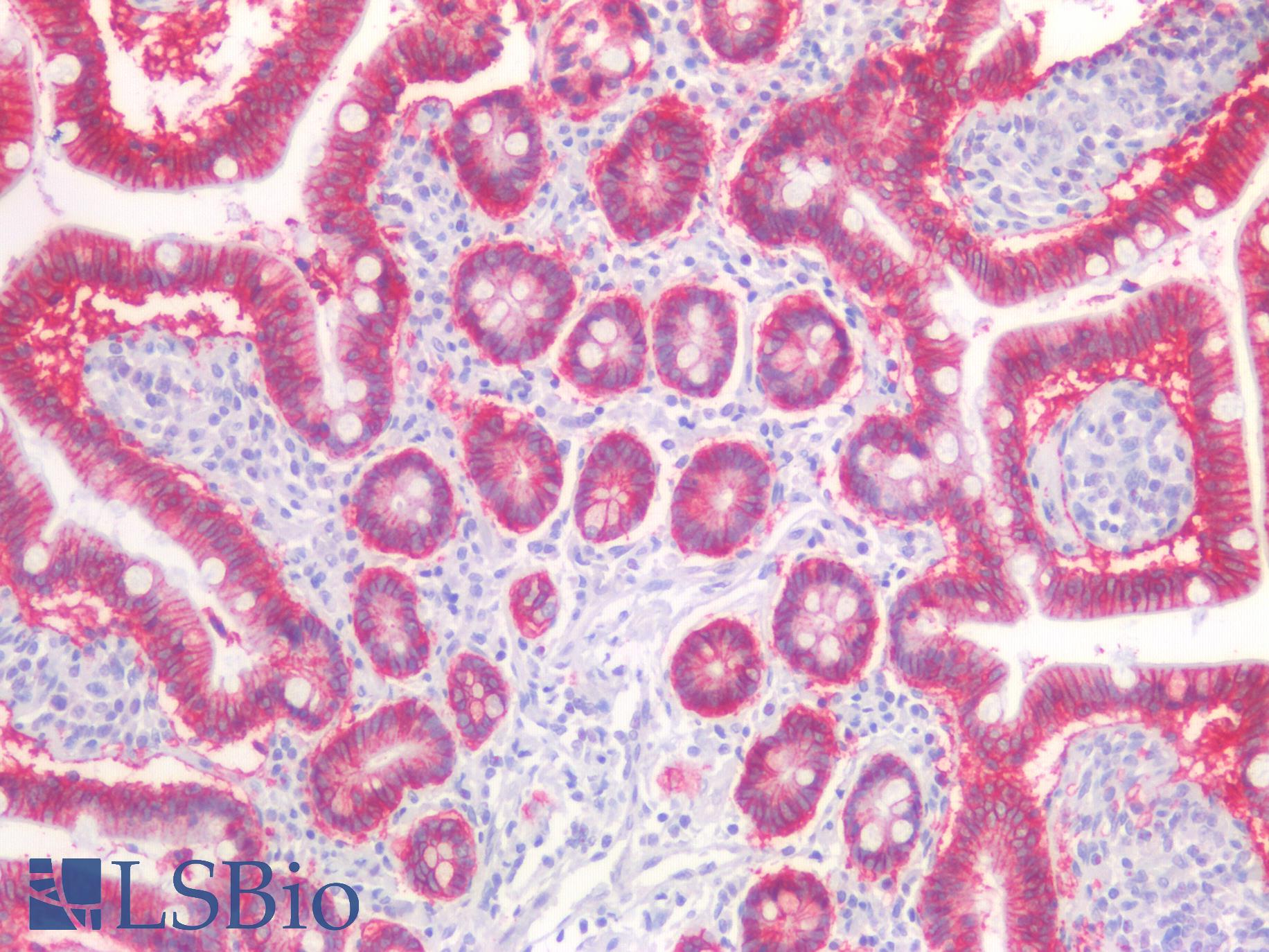 EPCAM Antibody - Human Small Intestine: Formalin-Fixed, Paraffin-Embedded (FFPE)