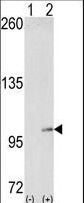 EPHA4 / EPH Receptor A4 Antibody - Western blot of EphA4 (arrow) using EphA4 Antibody. 293 cell lysates (2 ug/lane) either nontransfected (Lane 1) or transiently transfected with the EphA4 gene (Lane 2) (Origene Technologies).