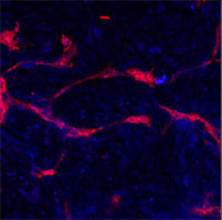 EPHA4 / EPH Receptor A4 Antibody - Methanol/Acetone fixed human stem cell is used in IF to detect Eph4A (blue) and endothelial Lectin(red). Data kindly provided by Dr. Weis from Cheresh Lab, UCSD.