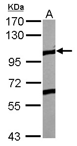 EPHA4 / EPH Receptor A4 Antibody - Sample (30 ug of whole cell lysate) A: HCT116 7.5% SDS PAGE EPHA4 antibody diluted at 1:1000