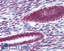 ER Alpha / Estrogen Receptor Antibody - Anti-Estrogen Receptor antibody IHC of human uterus. Immunohistochemistry of formalin-fixed, paraffin-embedded tissue after heat-induced antigen retrieval. Antibody concentration 10 ug/ml.
