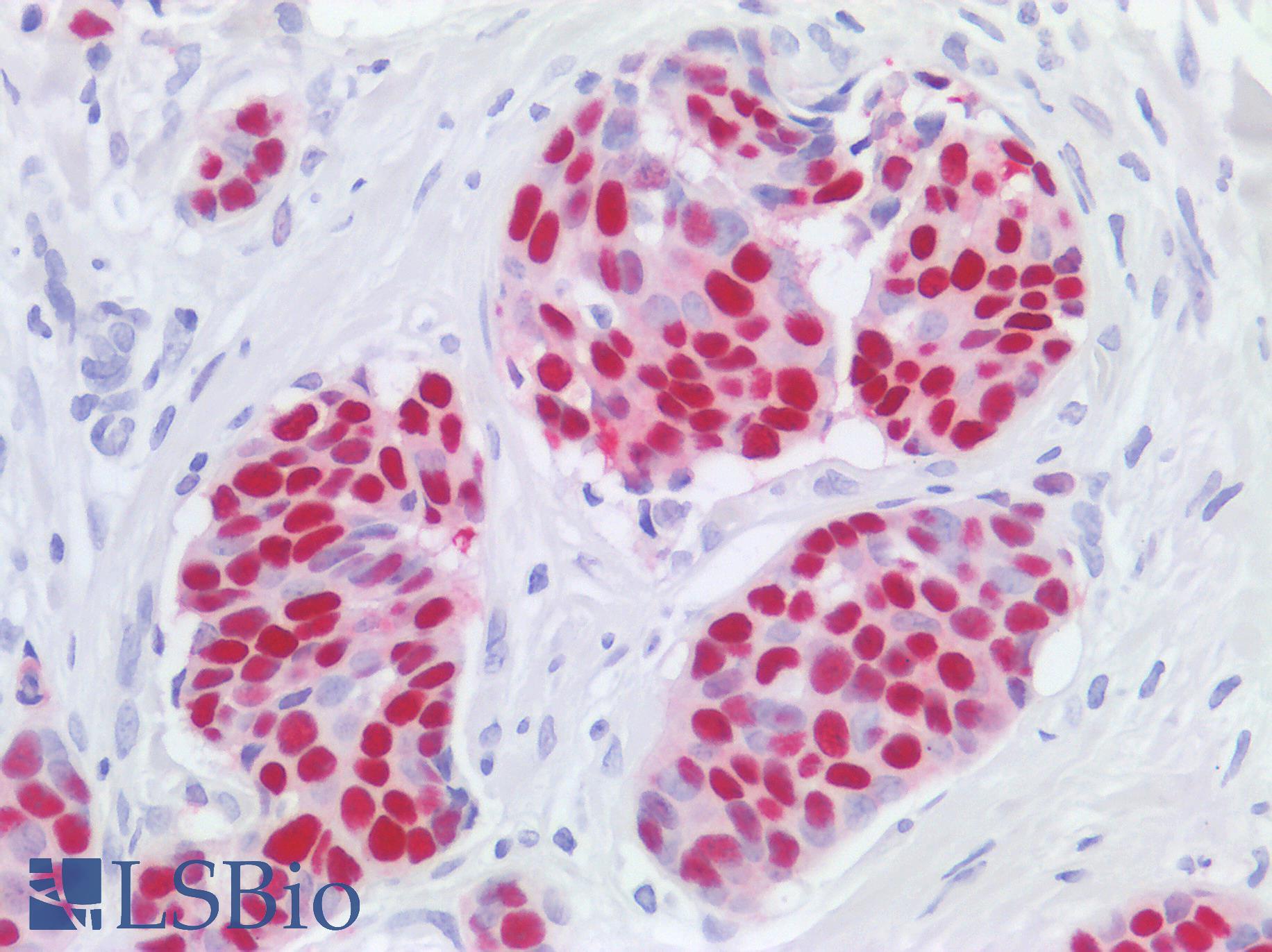 ER Alpha / Estrogen Receptor Antibody - Human Breast: Formalin-Fixed, Paraffin-Embedded (FFPE)