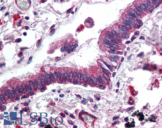 ERBB3 / HER3 Antibody - Anti-HER3 antibody IHC of human lung, respiratory epithelium. Immunohistochemistry of formalin-fixed, paraffin-embedded tissue after heat-induced antigen retrieval. Antibody concentration 5 ug/ml.