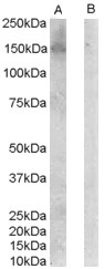 ERBB3 / HER3 Antibody - ERBB3 / HER3 antibody (0.1ug/ml) staining of Jurkat lysate (35ug protein in RIPA buffer) with (B) and without (A) blocking with the immunising peptide. Detected by chemiluminescence.