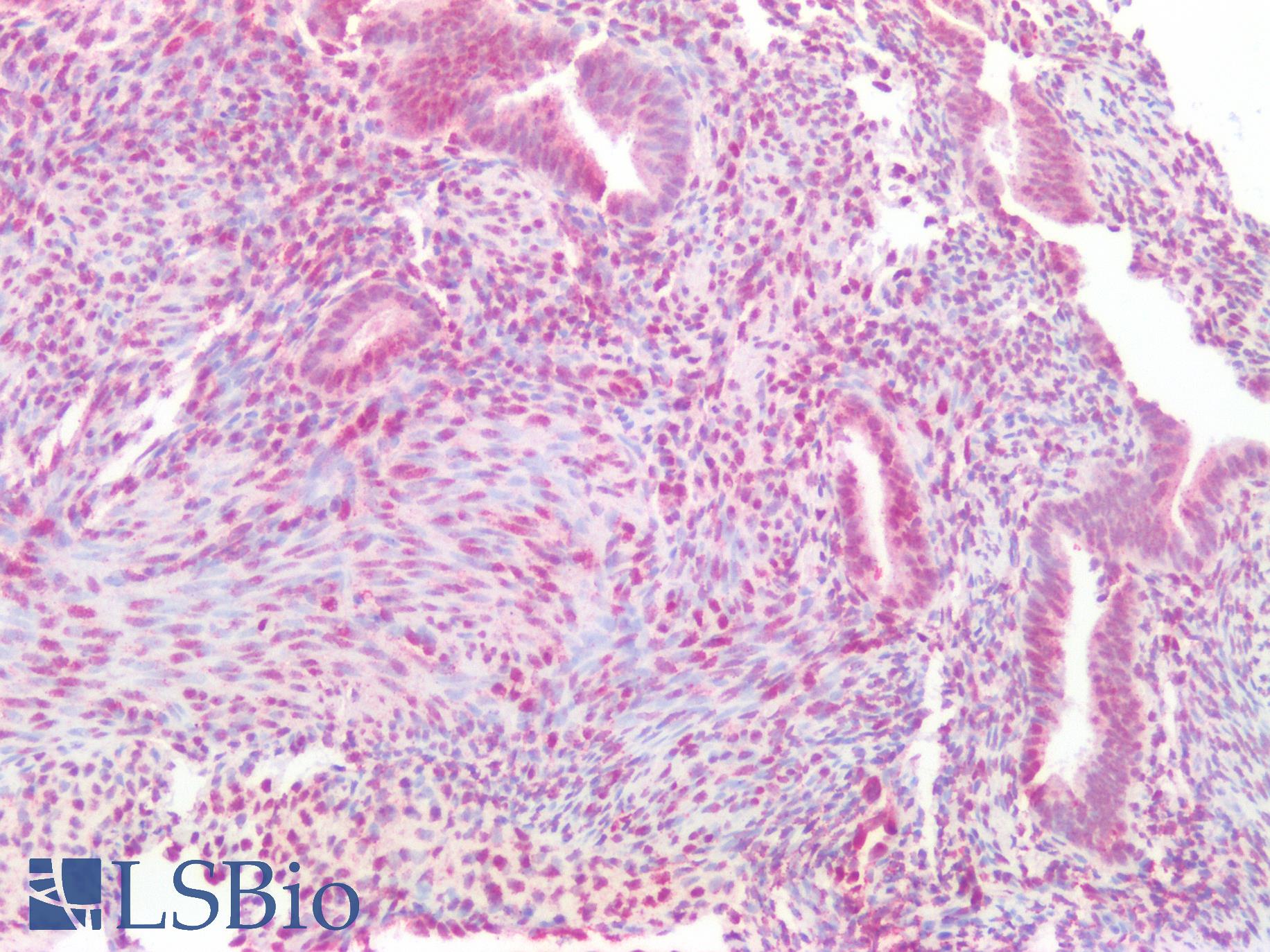 ERG Antibody - Human Uterus: Formalin-Fixed, Paraffin-Embedded (FFPE)